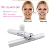 SOHAIL LLC Blue Light Therapy Acne Laser Pen Soft Scar Wrinkle Removal Treatment Device