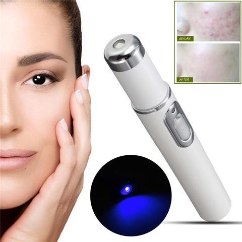 SOHAIL LLC Blue Light Therapy Acne Laser Pen Soft Scar Wrinkle Removal Treatment Device